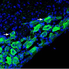Anti-Nicotinic Acetylcholine Receptor α9 (CHRNA9) Antibody