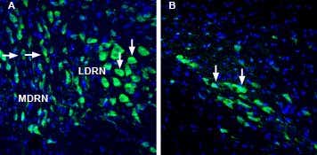 Anti-Lynx1 (extracellular) Antibody