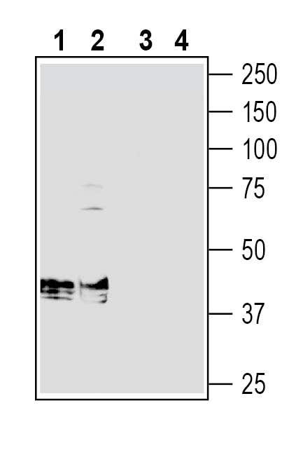 Beta 1 Na+/K+ ATPase (extracellular) Blocking Peptide