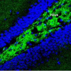 Anti-Synaptotagmin-1 (SYT1) Antibody