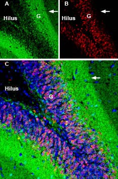 Anti-GAP43 Antibody