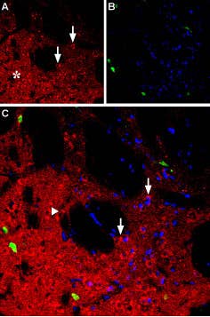 Anti-NPY1R Antibody