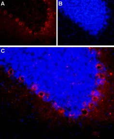 Anti-NPY2R Antibody