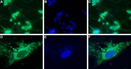 Anti-NPY4R Antibody