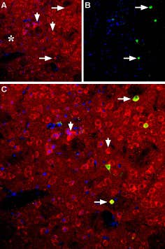 Anti-NPY5R Antibody