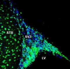 Anti-NPY1R (extracellular) Antibody