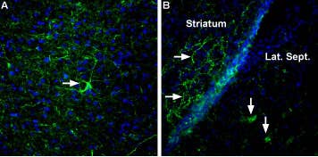 Anti-Neurexin 3α (extracellular) Antibody