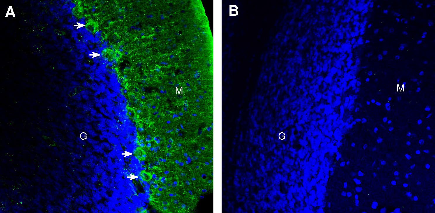 Anti-DSCAM (extracellular) Antibody