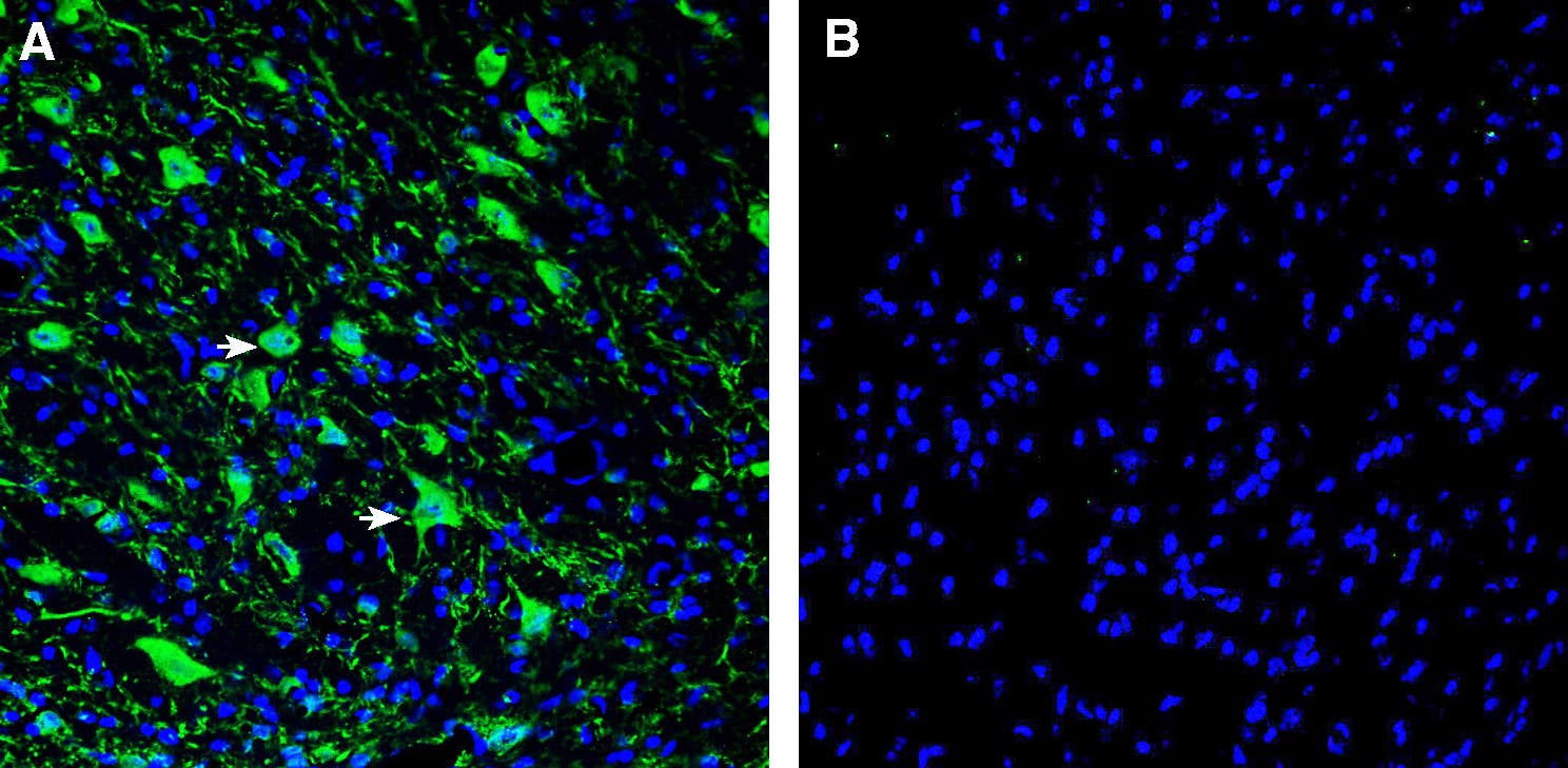 Anti-L1CAM (extracellular) Antibody