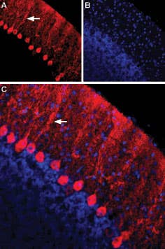 Anti-Nectin-1/PVRL1 (extracellular) Antibody