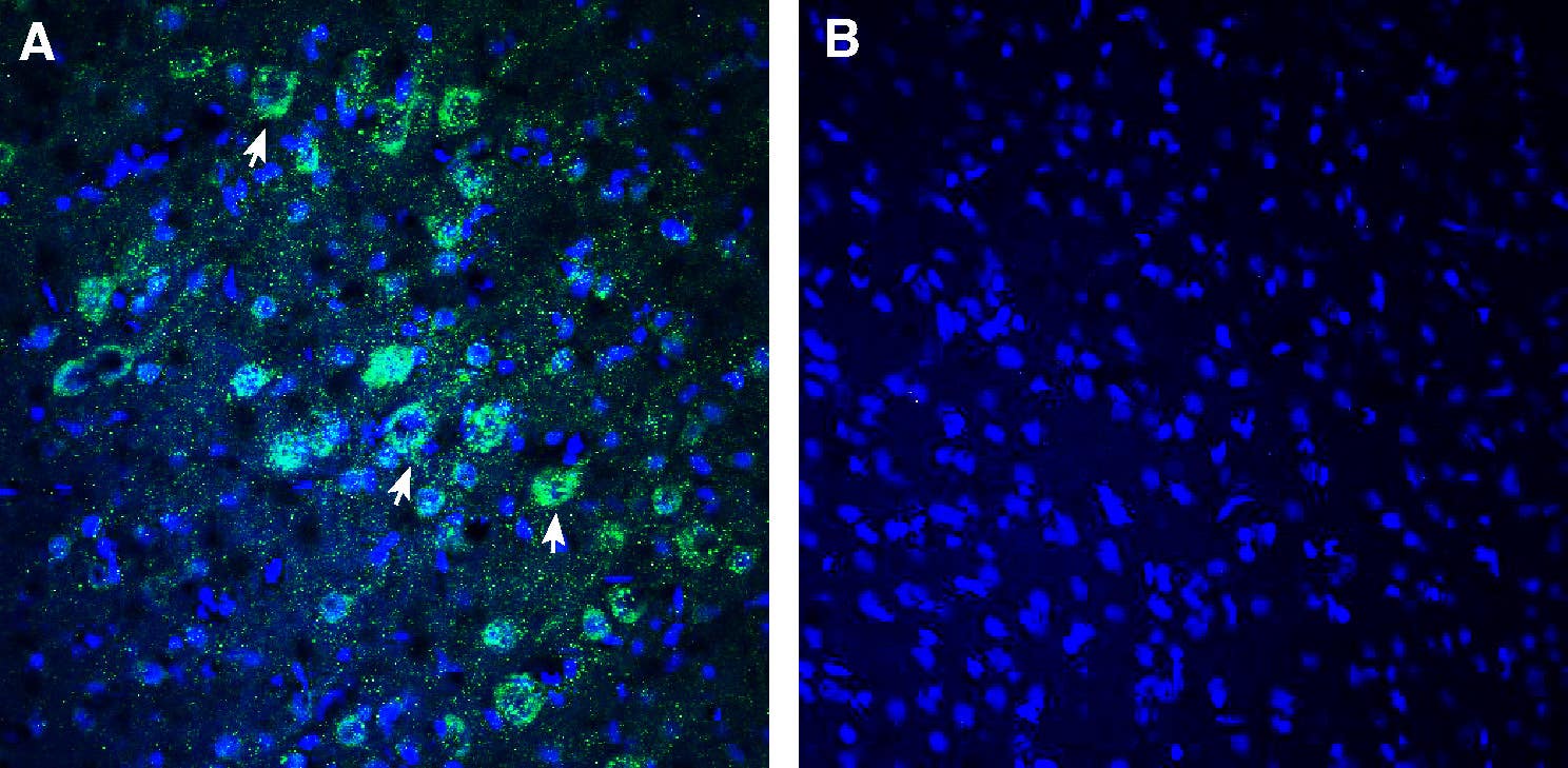 Anti-NEGR1 (extracellular) Antibody