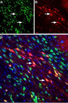 Anti-Neuropilin-2 (NRP2) (extracellular) Antibody