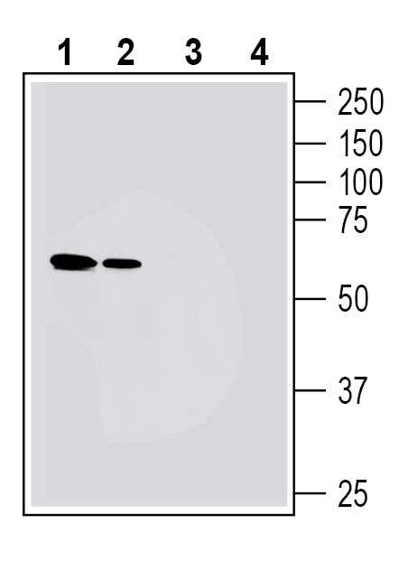 NMUR1 (extracellular) Blocking Peptide
