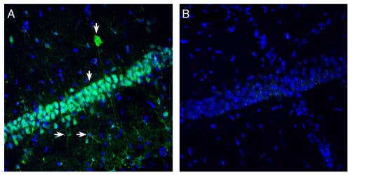 Anti-NMUR2 (extracellular) Antibody