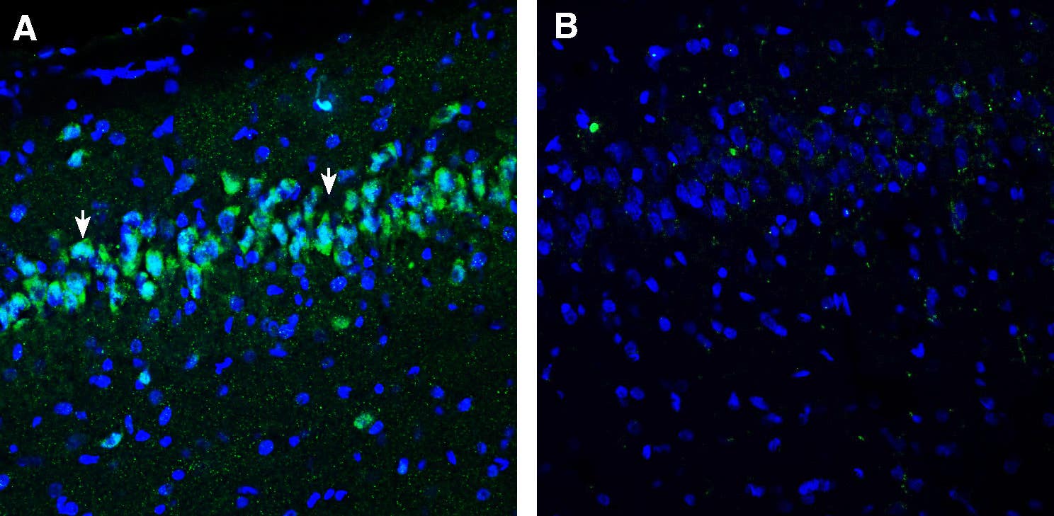 Anti-Neuropeptide FF Receptor 1 (extracellular) Antibody