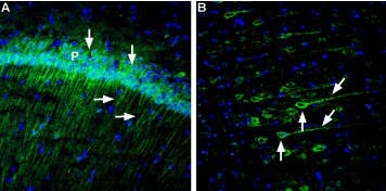 Anti-Neuroplastin (extracellular) Antibody