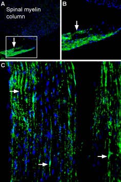 Anti-Periaxin Antibody