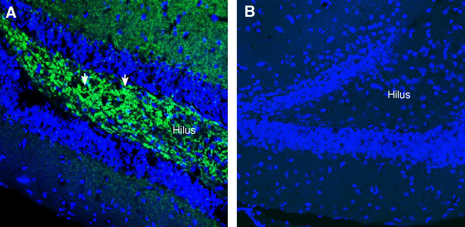 Anti-SV2A Antibody