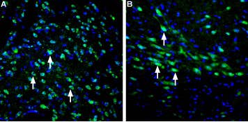 Anti-LRRK2 Antibody