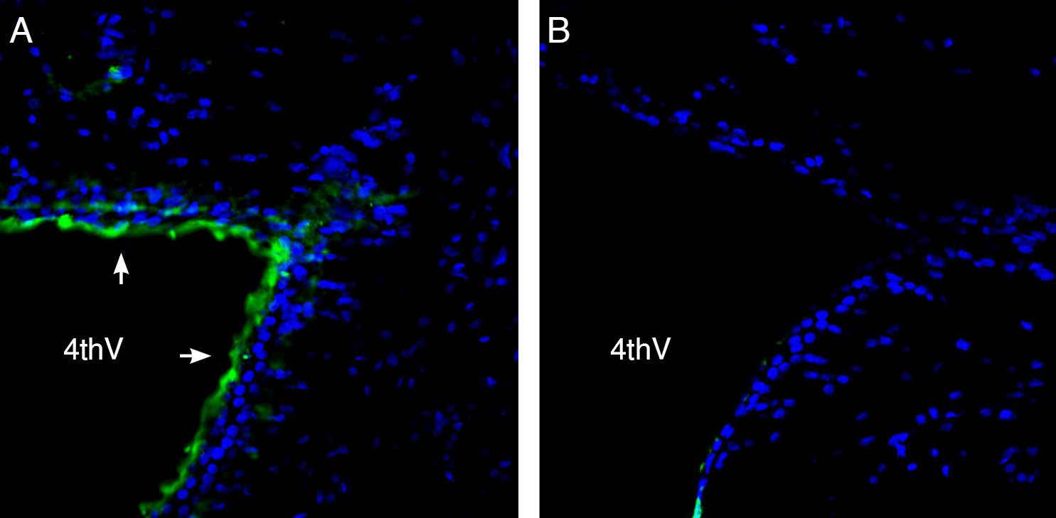 Anti-Parkin Antibody