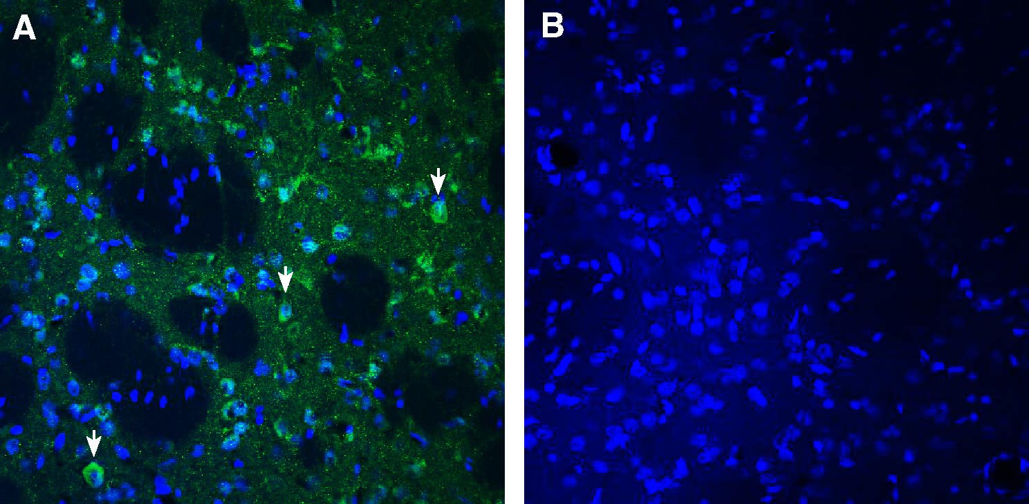 Anti-SLC25A18 (GC2) Antibody