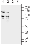 ADAM22 (extracellular) Blocking Peptide