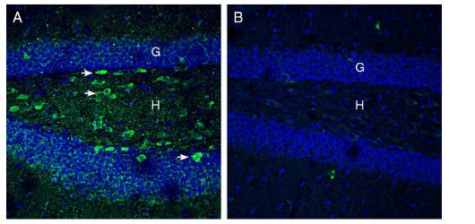 Anti-Netrin-1 Antibody