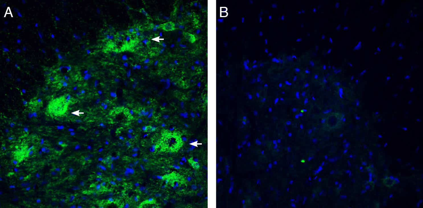 Anti-Netrin-3 Antibody