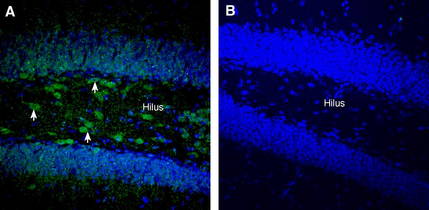 Anti-RGMA (extracellular) Antibody