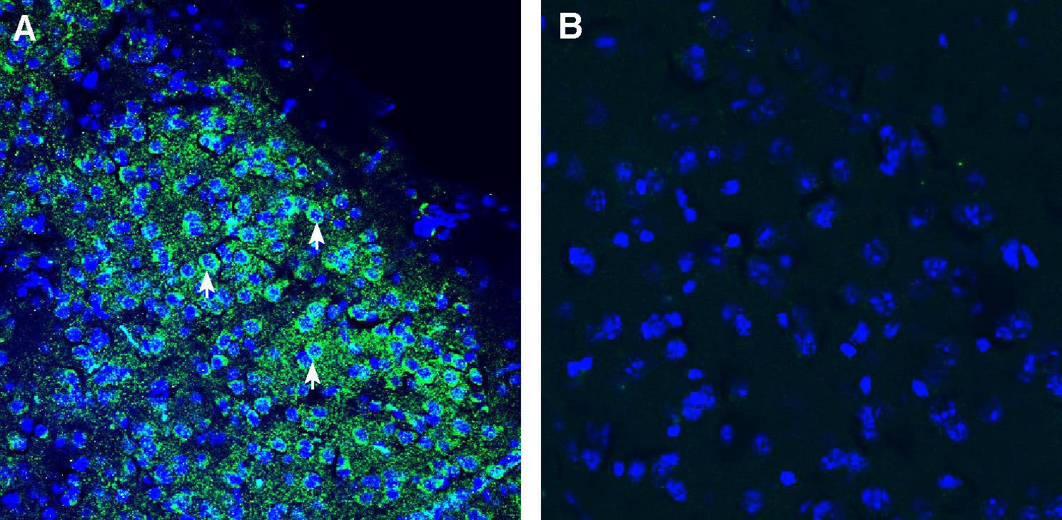 Anti-SORCS1 (extracellular) Antibody