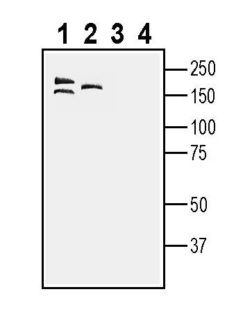 SORCS1 (extracellular) Blocking Peptide