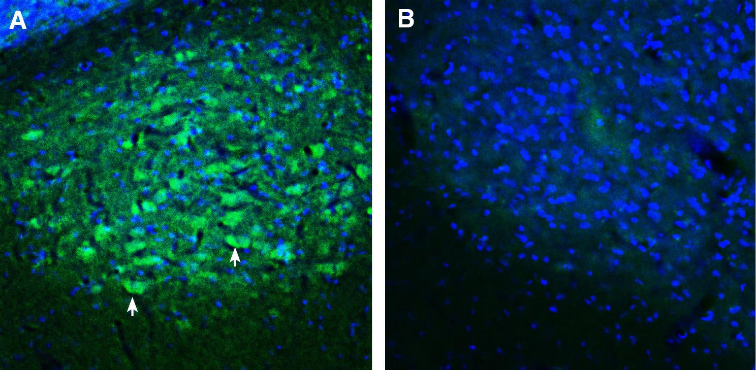 Anti-SORCS2 (extracellular) Antibody