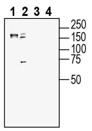 SORCS2 (extracellular) Blocking Peptide
