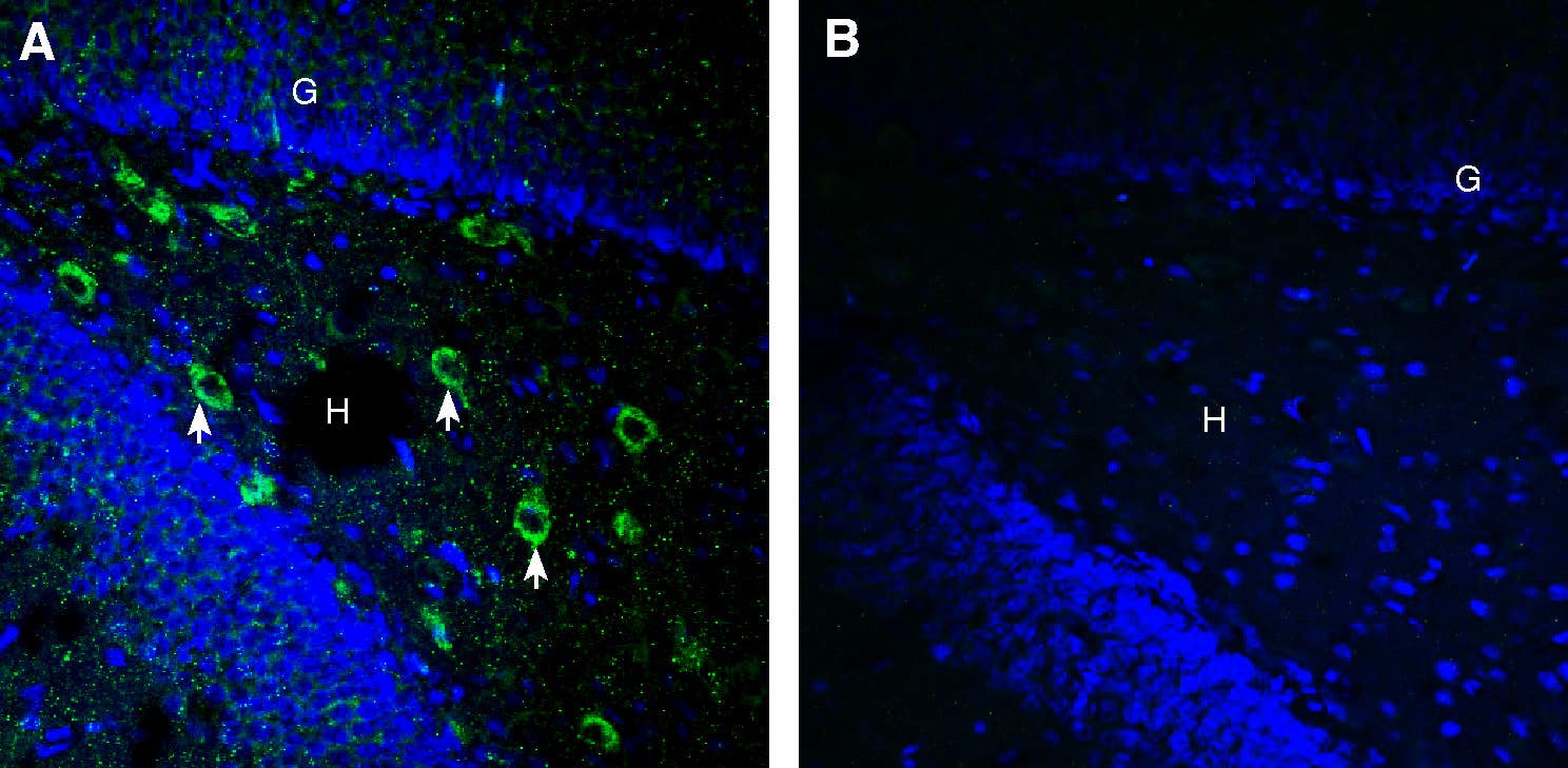 Anti-SARM1 Antibody