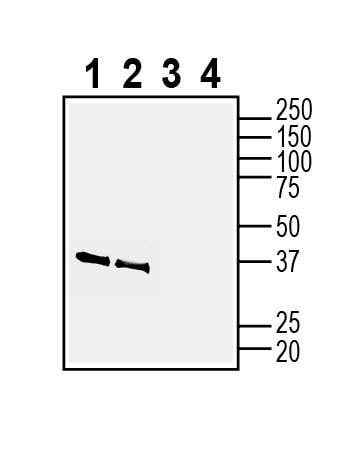 NMNAT2 Blocking Peptide