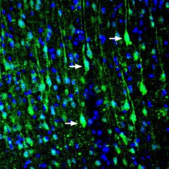 Anti-LRRTM1 (extracellular) Antibody