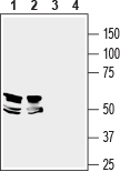 LRRTM1 (extracellular) Blocking Peptide