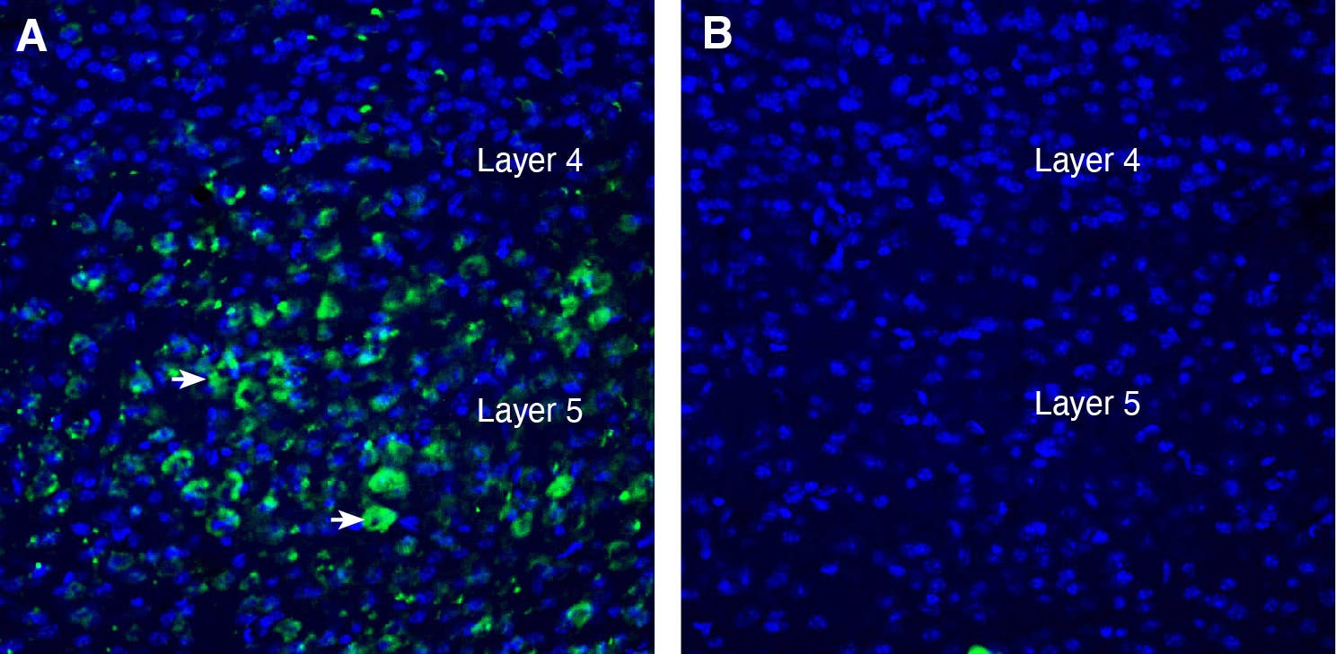 Anti-LRRTM2 (extracellular) Antibody