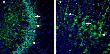 Anti-ASTN1 (extracellular) Antibody