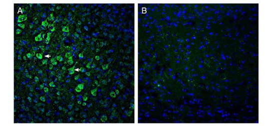 Anti-ADAM10 (extracellular) Antibody