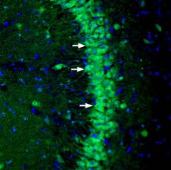 Anti-NGL-3/LRRC4B (extracellular) Antibody