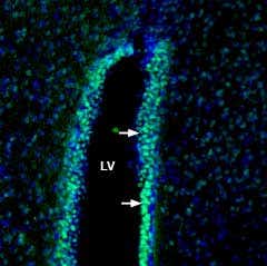 Anti-Contactin-1/CNTN1 (extracellular) Antibody