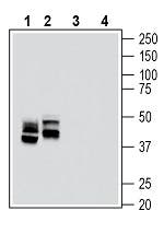 Anti-RAGE (extracellular) Antibody