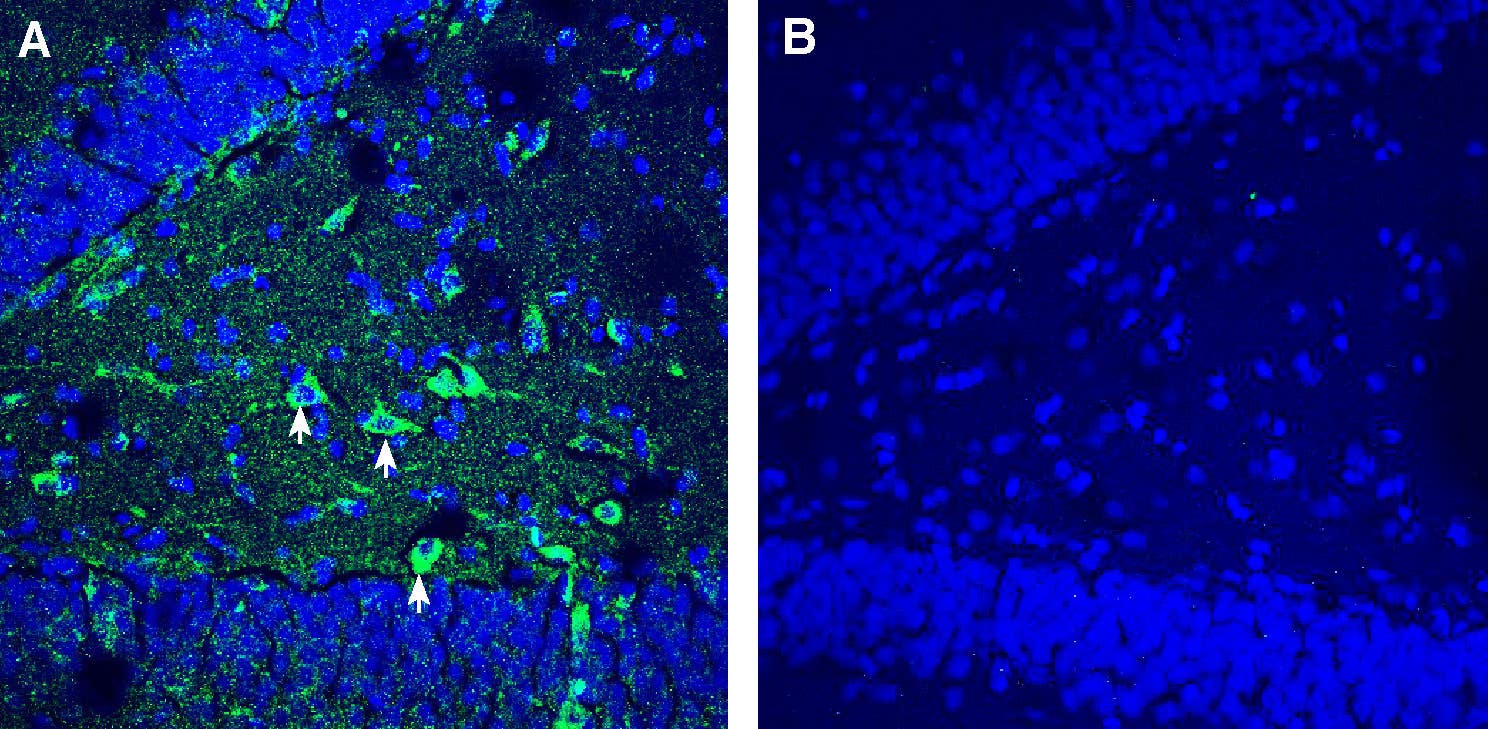 Anti-TMEM106B (extracellular) Antibody