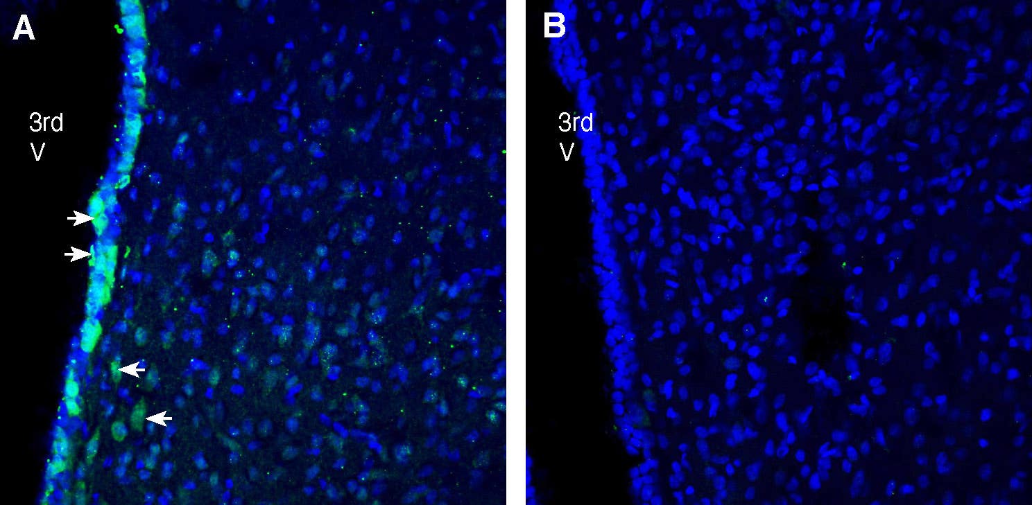 Anti-Progranulin Antibody