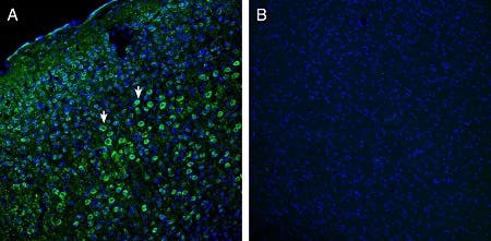 Anti-Robo1 (extracellular) Antibody