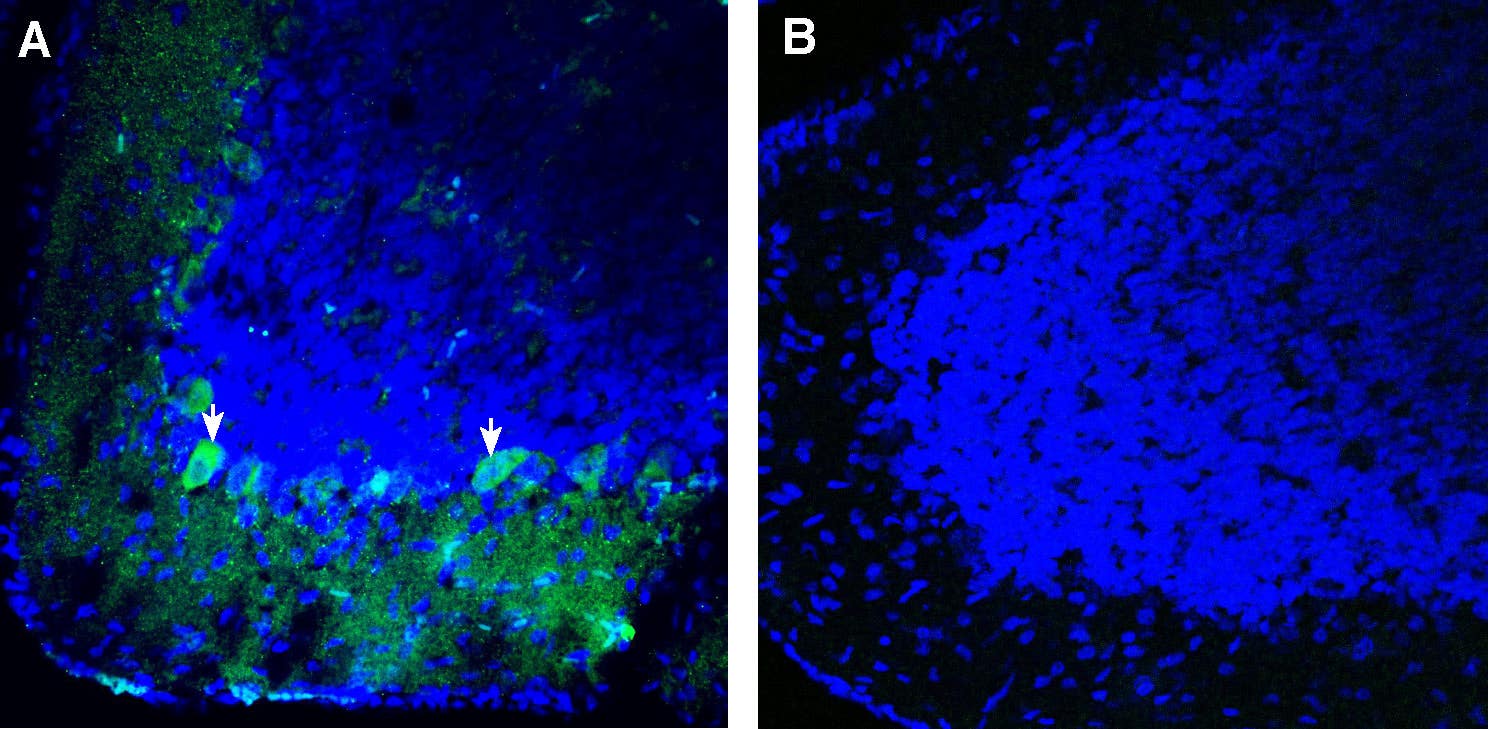 Anti-Robo3 (extracellular) Antibody