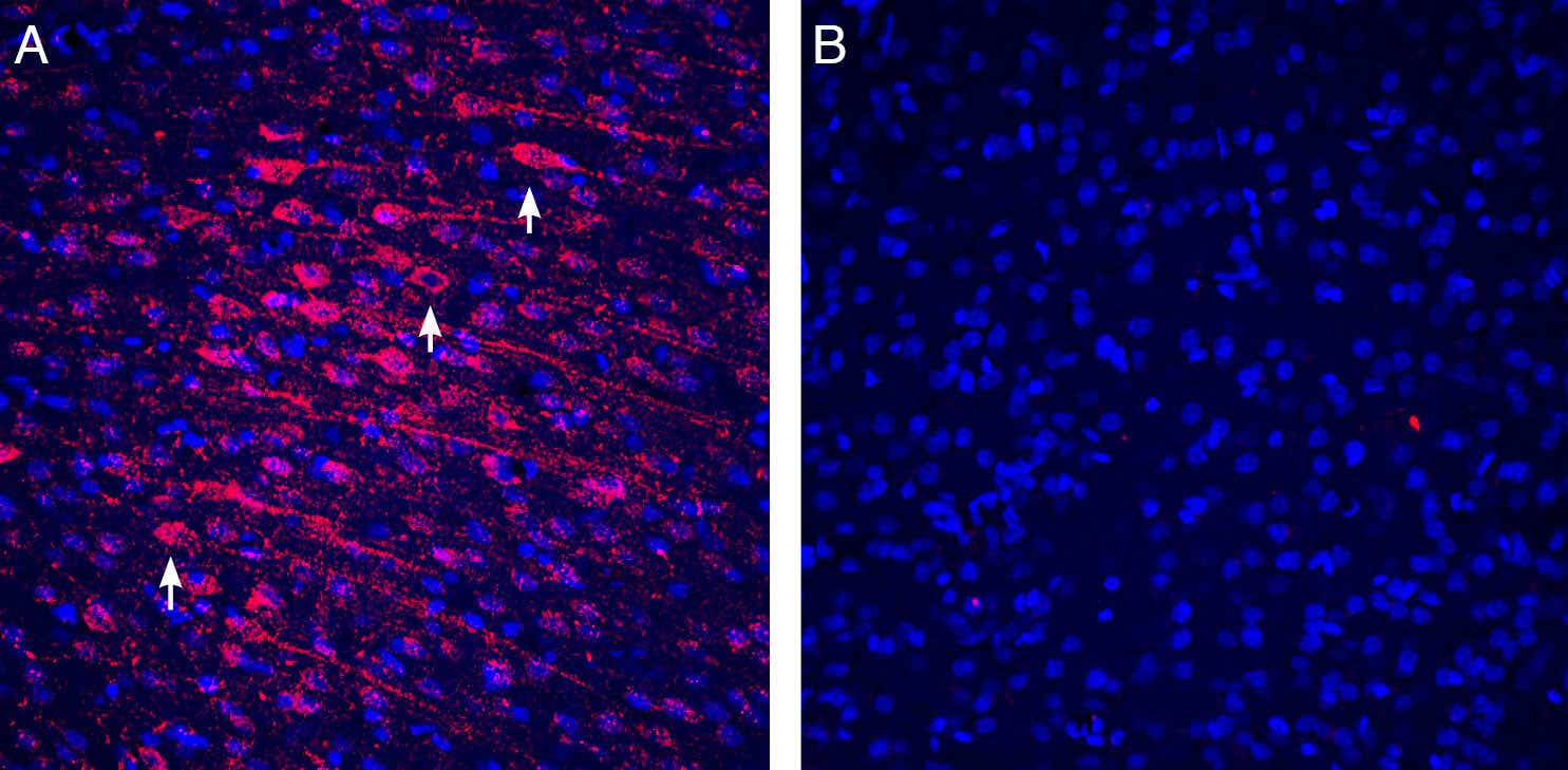 Anti-Tetraspanin-3 (extracellular) Antibody