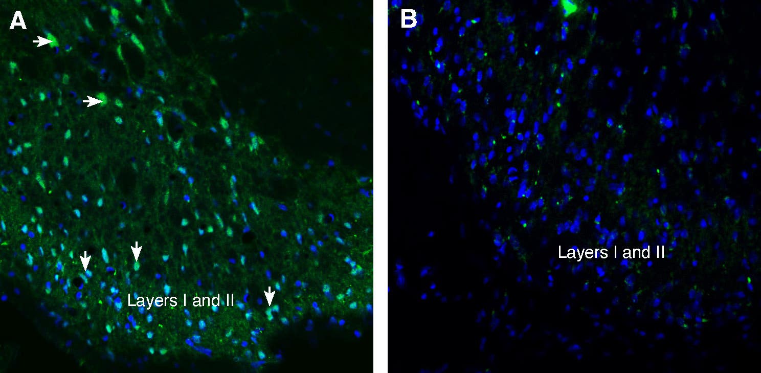 Anti-Tetraspanin 2 (extracellular) Antibody