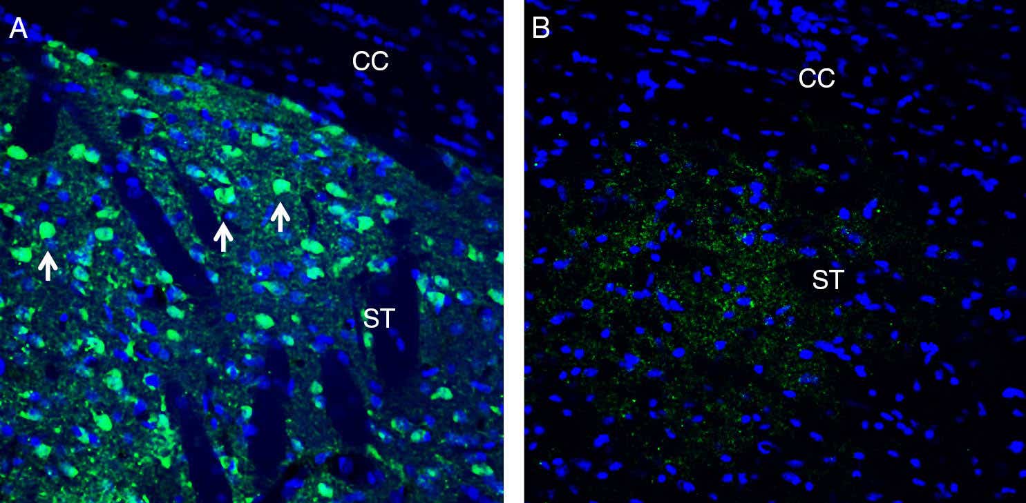 Anti-Neuronal Pentraxin 1 (NPTX1) Antibody